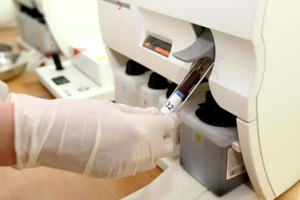 vađenje uzorka iz aparata